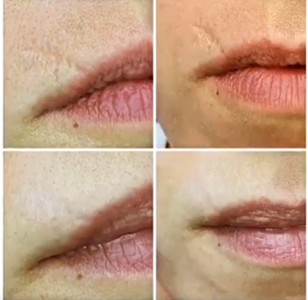 img clinicabelitte (20)